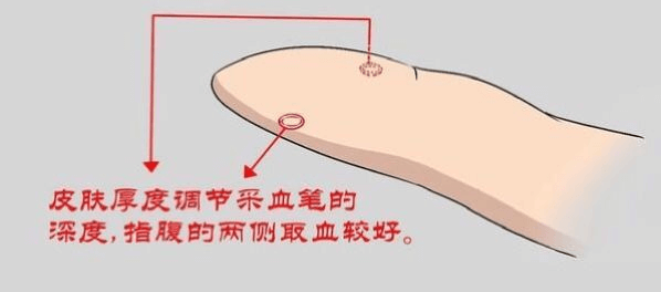  居家测血糖注意“五个要”